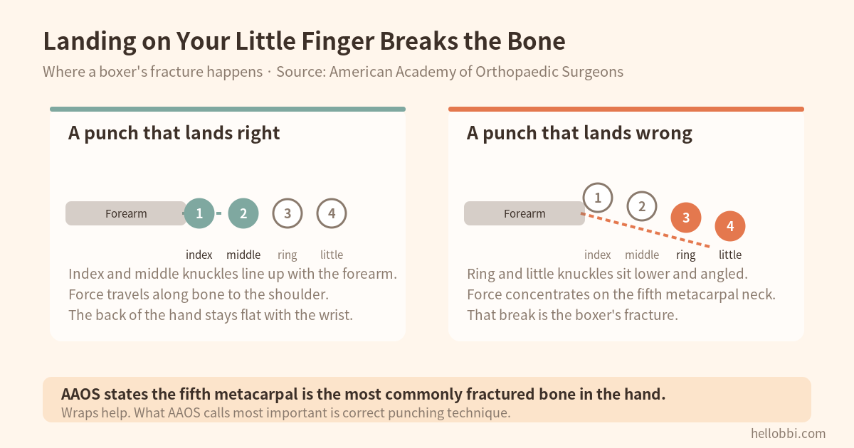 Where a boxer’s fracture happens