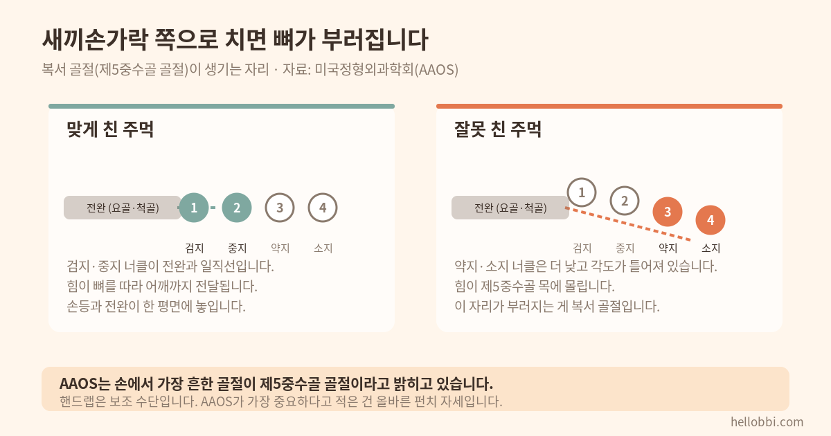 복서 골절이 생기는 자리